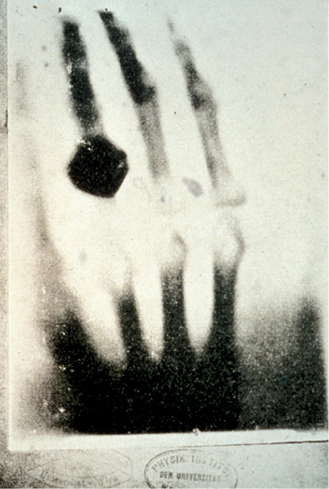 Première radiographie