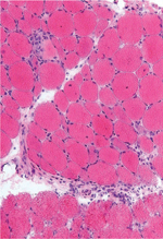 inline-graphic medsci190178s-img1.jpg