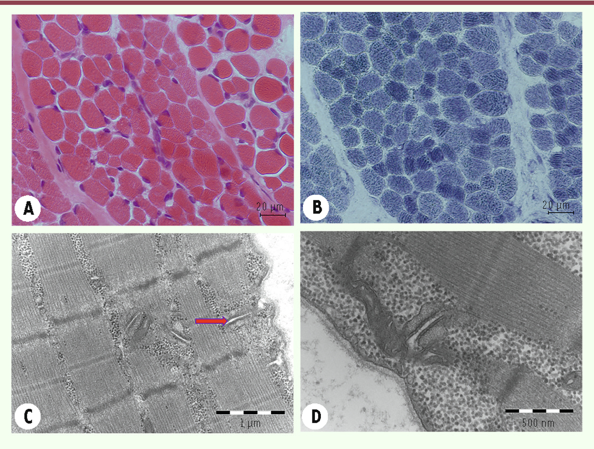 Figure 11.