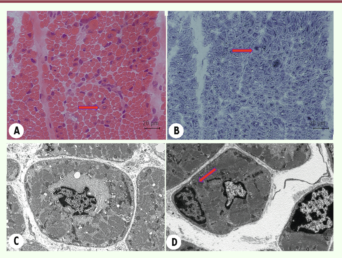 Figure 12.