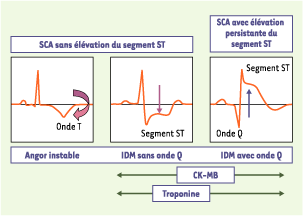 inline-graphic medsci2004203p291-img1.gif