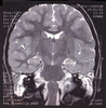 Figure 1. Figure 1.