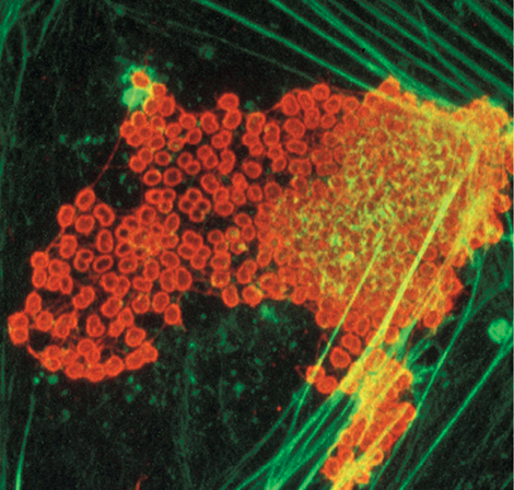 Cellules endothéliales infectées