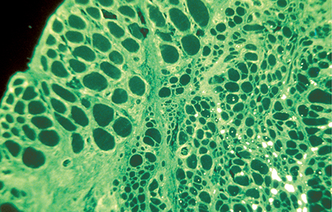 Greffe de cellules satellites dans un muscle de rat.