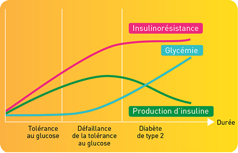 Avant de développer un diabète de type 2, le malade passe par plusieurs stades.