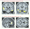Figure 1 Figure 1
