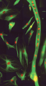 inline-graphic medsci2012286-7p577-img1.jpg