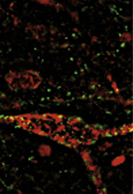 inline-graphic medsci2013296-7p597-img1.jpg