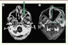 Figure 1. Figure 1.