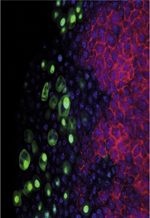 inline-graphic medsci20143001p76-img1.jpg