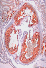 inline-graphic medsci20143005p526-img1.jpg