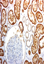 inline-graphic medsci20153101p43-img1.jpg