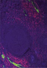 inline-graphic medsci20153111p989-img1.jpg