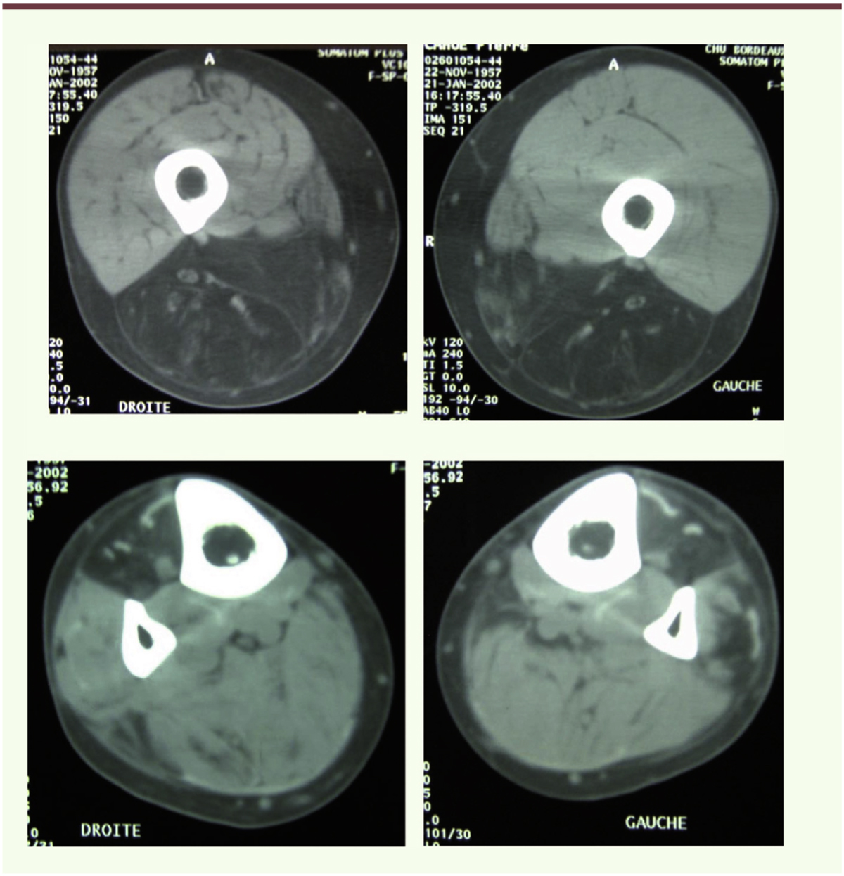 Figure 4.