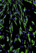 inline-graphic medsci2015313sp28-img1.jpg