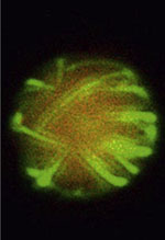 inline-graphic medsci20153112p1126-img1.jpg