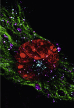 inline-graphic medsci20163202p167-img1.jpg