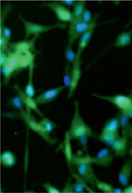inline-graphic medsci20163203p267-img1.jpg