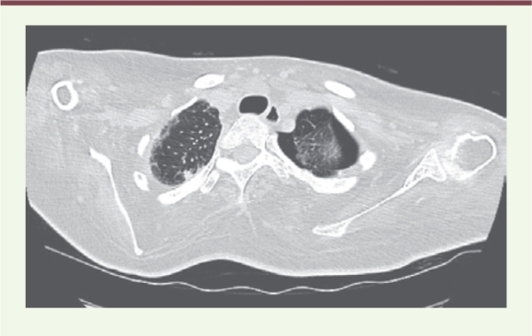 inline-graphic medsci201733s1p27-img3.jpg