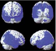 inline-graphic medsci20183401p41-img3.jpg