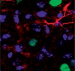 inline-graphic medsci180191s-img2.jpg